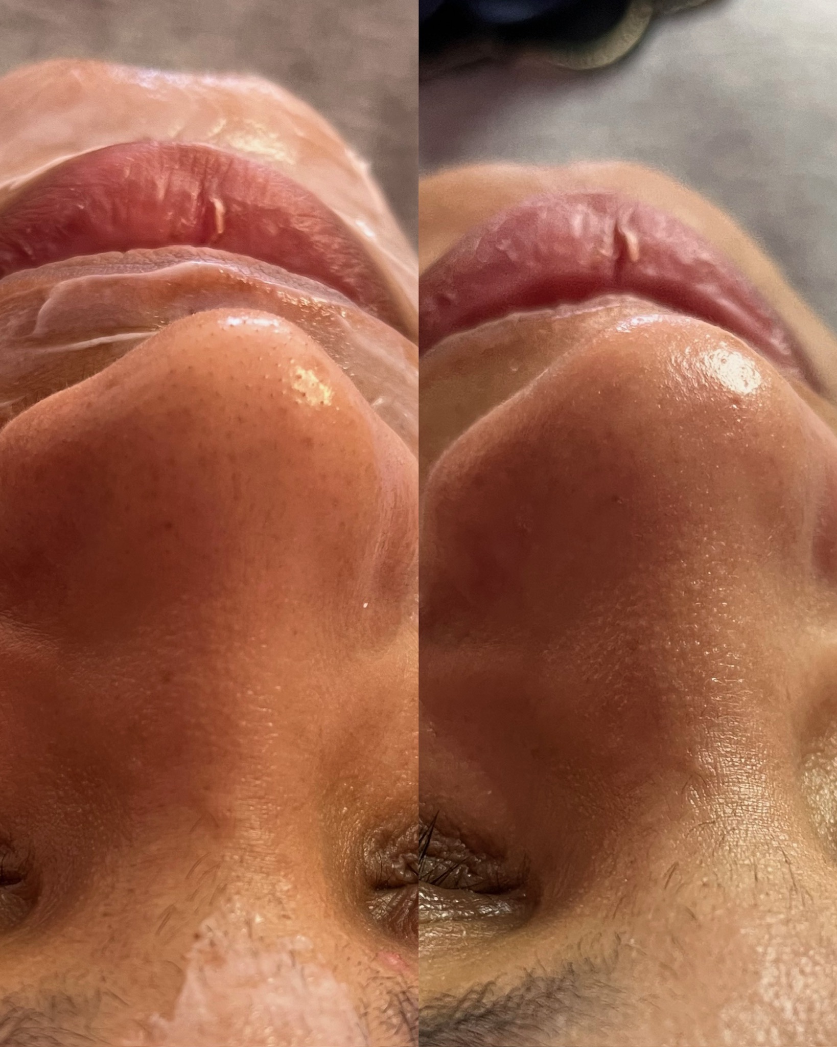 Imagem do produto Limpeza de pele